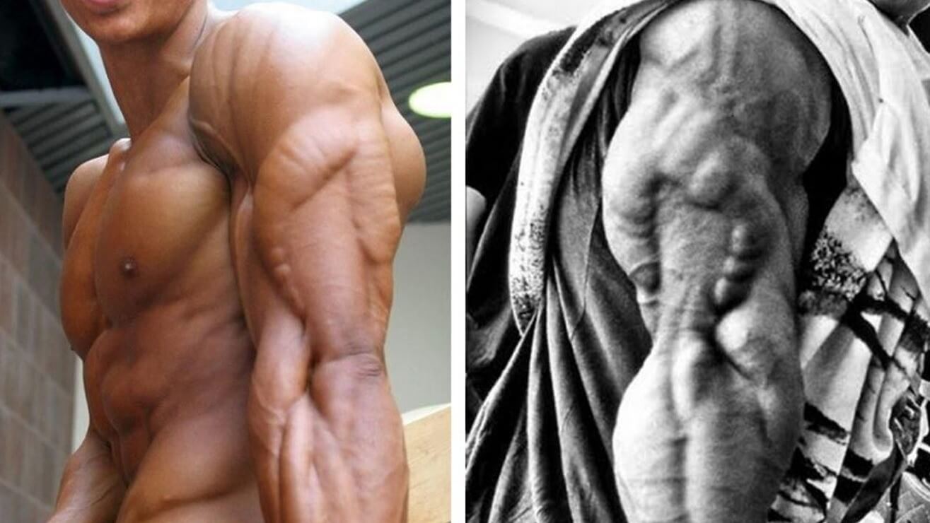 triceps vs biceps