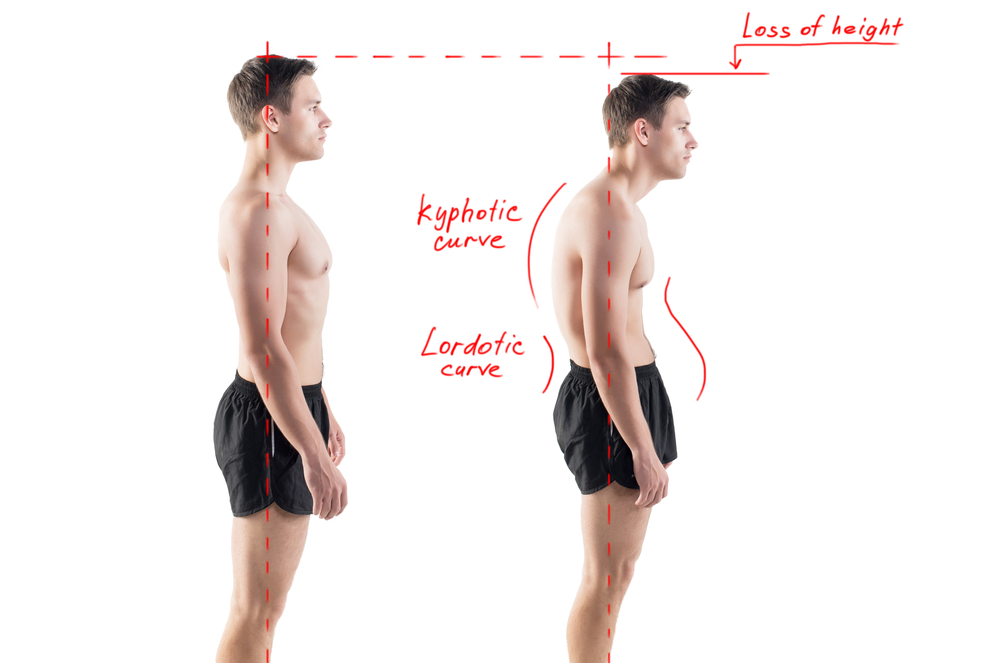 Fixing your posture can help you gain extra height that is hidden by a bad posture