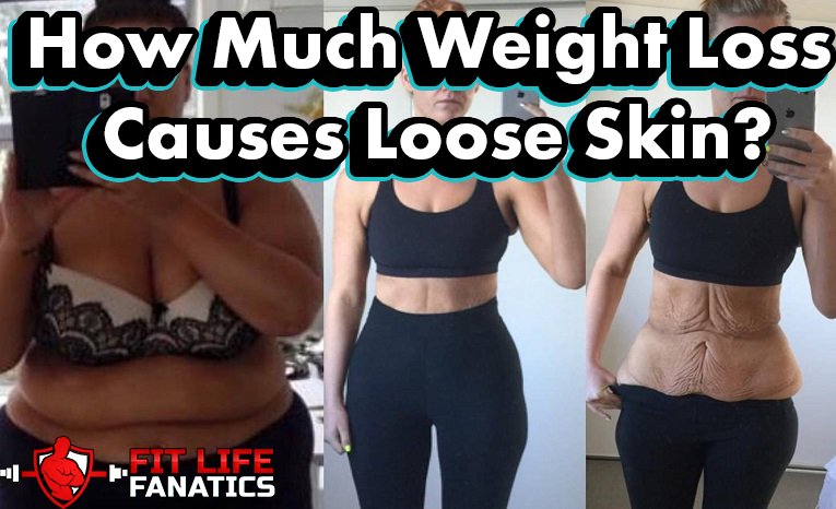 How Much Weight Loss Causes Loose Skin FitLifeFanatics